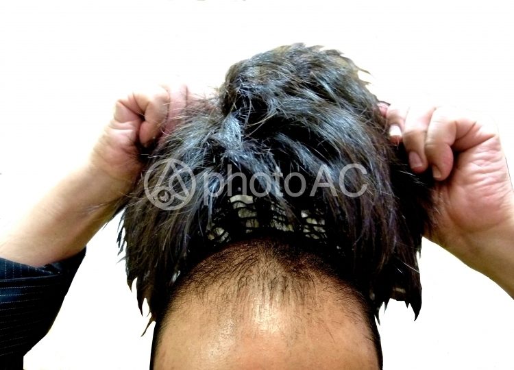 中居正広の髪型はハゲでかつら?若い頃〜2024最新までの変化も!